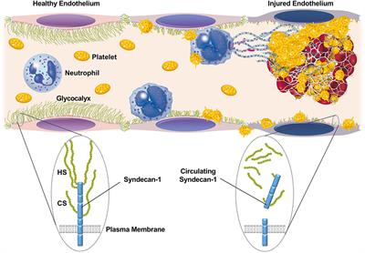 Circulating Syndecan-1 as a Predictor of Persistent Thrombocytopenia and Lethal Outcome: A Population Study of Patients With Suspected Sepsis Requiring Intensive Care